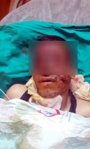 madende-elinde-dinamit-patladi-7508082_6464_m