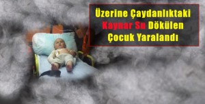 Üzerine Kaynar Su Dökülen Çocuk Yaralandı