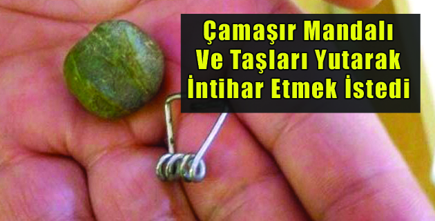 Çamaşır Mandalı Ve Taşları Yutarak İntihar Etmek İstedi