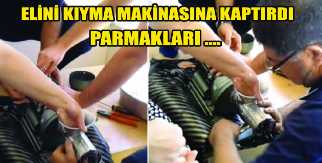 ELİNİ KIYMA MAKİNESİNE KAPTIRDI PARMAKLARI…