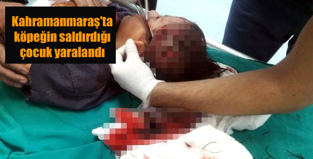 Kahramanmaraş’ta köpeğin saldırdığı çocuk yaralandı