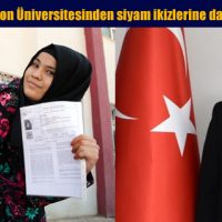 Trabzon Üniversitesinden siyam ikizlerine davet