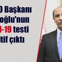 Balcıoğlu’nun Kovid-19 testi pozitif çıktı